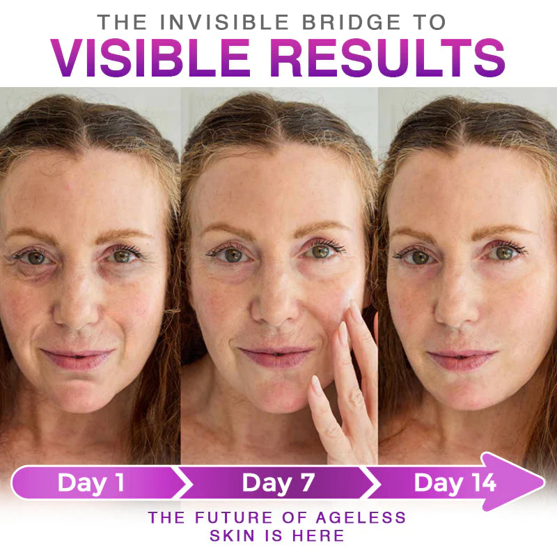๐พ๐๐ง๐๐ฝ๐ง๐๐๐ฏ๐ยฎ Microneedle Anti-Aging Patch ๐ - Image 5