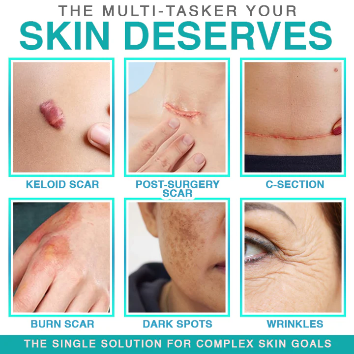 𝘾𝙖𝙧𝙚𝘽𝙧𝙚𝙚𝙯𝙚® Microneedle Scar Care Patch - Image 2