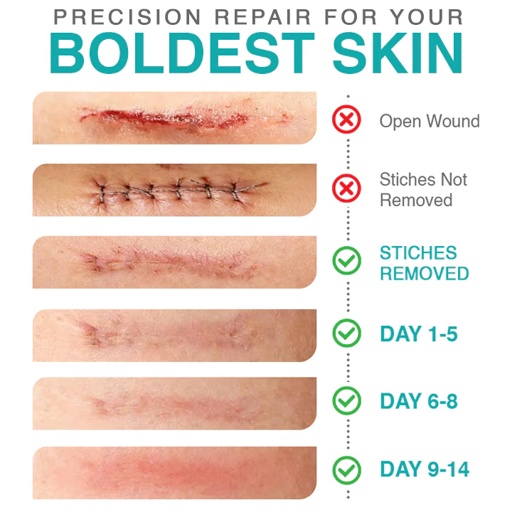 CareBreeze® Micro-Needle Scar Care Patch 👑 - Image 7