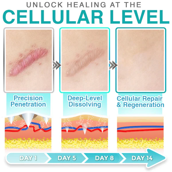CareBreeze® Micro-Needle Scar Care Patch 👑 - Image 9