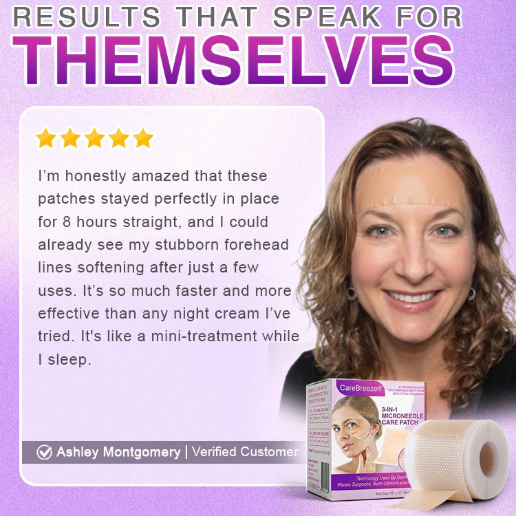 ๐พ๐๐ง๐๐ฝ๐ง๐๐๐ฏ๐ยฎ Microneedle Anti-Aging Care Patch - Image 9