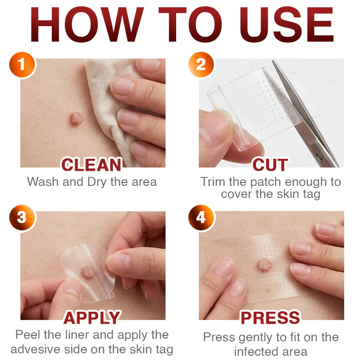 CareBreeze® Skin Tag Removal Micro-needle Patch 🧬 - Image 10