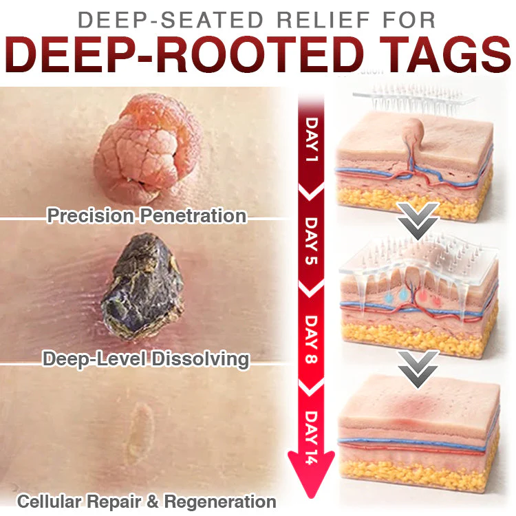 CareBreeze® Skin Tag Removal Micro-needle Patch 🧬 - Image 6